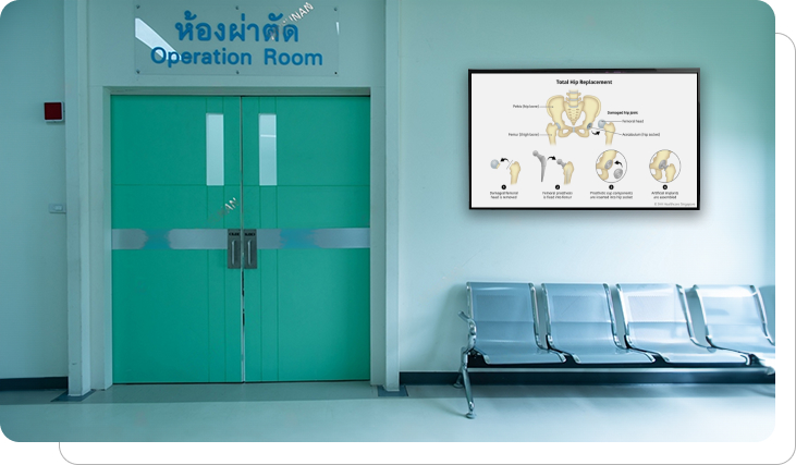 Surgery digital signage showing surgical visualizations Surgery digital signage showing surgical visualizations